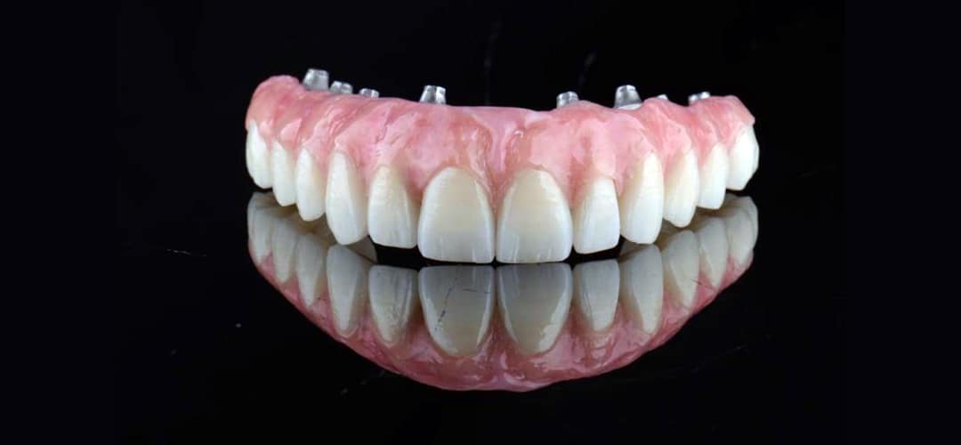 7dayliverestorativeonhybridsoverdenturesandzirconiacrowns